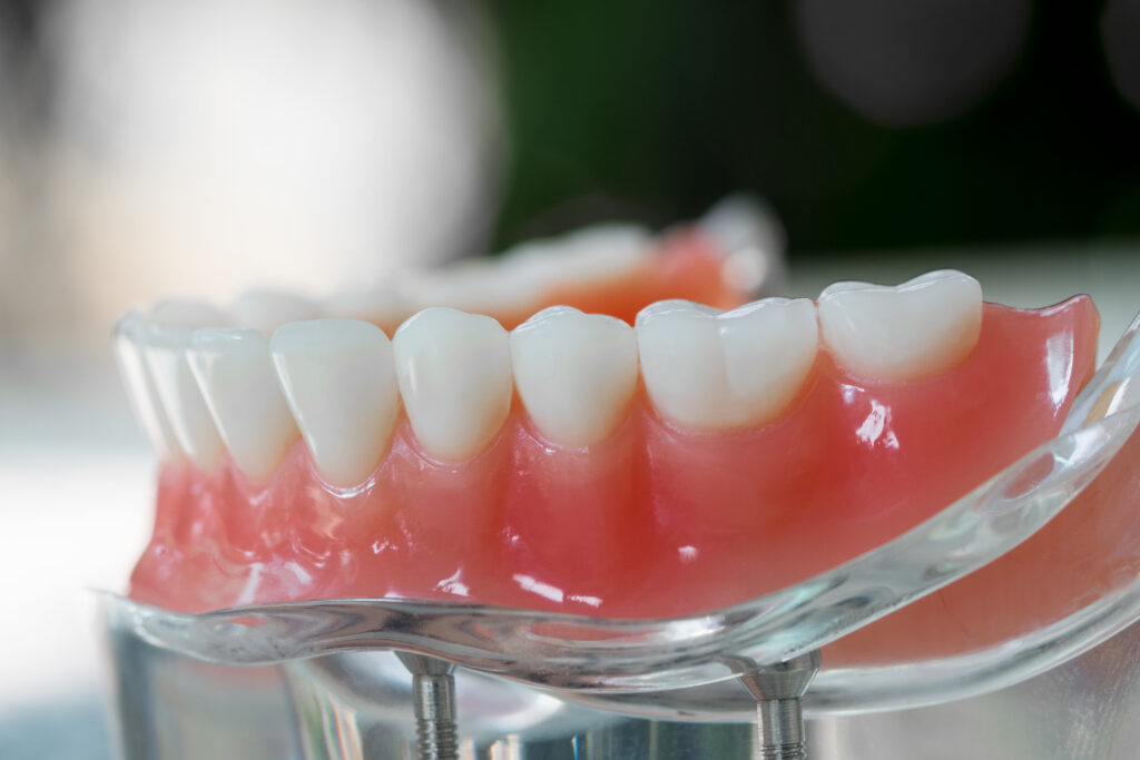 https://nuvedental.com/wp-content/uploads/2021/10/dentures-prosthodontics-dental-dentist-nuve-dallas-1-1024x683.jpg